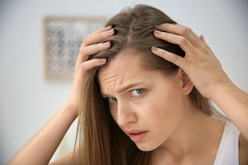 HairLossWOMEN